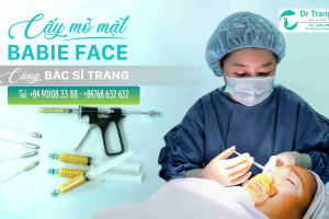 Cấy Mỡ Mặt Baby Face