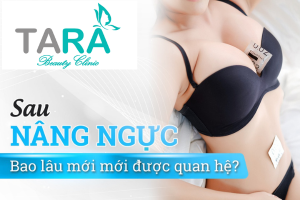 Nâng Ngực Bao Lâu Được Quan Hệ Vợ Chồng?