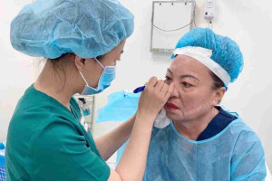 Khám phá phương pháp lấy mỡ bọng mắt hiệu quả