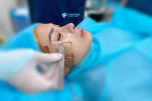 7 lưu ý quan trọng trước khi nâng mũi mà bạn cần phải biết