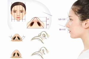 Bác sĩ giải đáp: Cắt cánh mũi có làm mũi cao lên không?