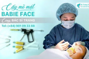 Cấy mỡ mặt babyface có nguy hiểm không?