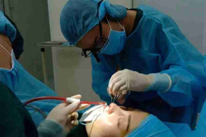 Review nâng mũi sụn Surgiform đẹp bền chất lượng