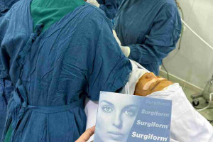 Nâng mũi sụn Surgiform có đắt không? Giá bao nhiêu?