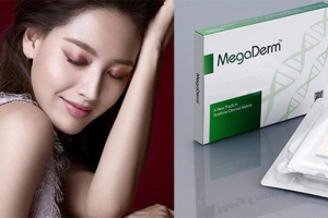Tổng quan về phương pháp nâng mũi bọc sụn Megaderm