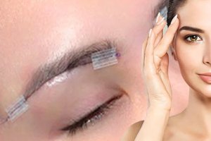 Treo cung chân mày – Giải pháp cho đôi mắt trẻ trung, to tròn