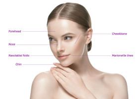 Giải đáp về CaHA trong tiêm trẻ hoá tạo hình khuôn mặt