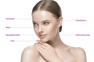 Giải đáp về CaHA trong tiêm trẻ hoá tạo hình khuôn mặt